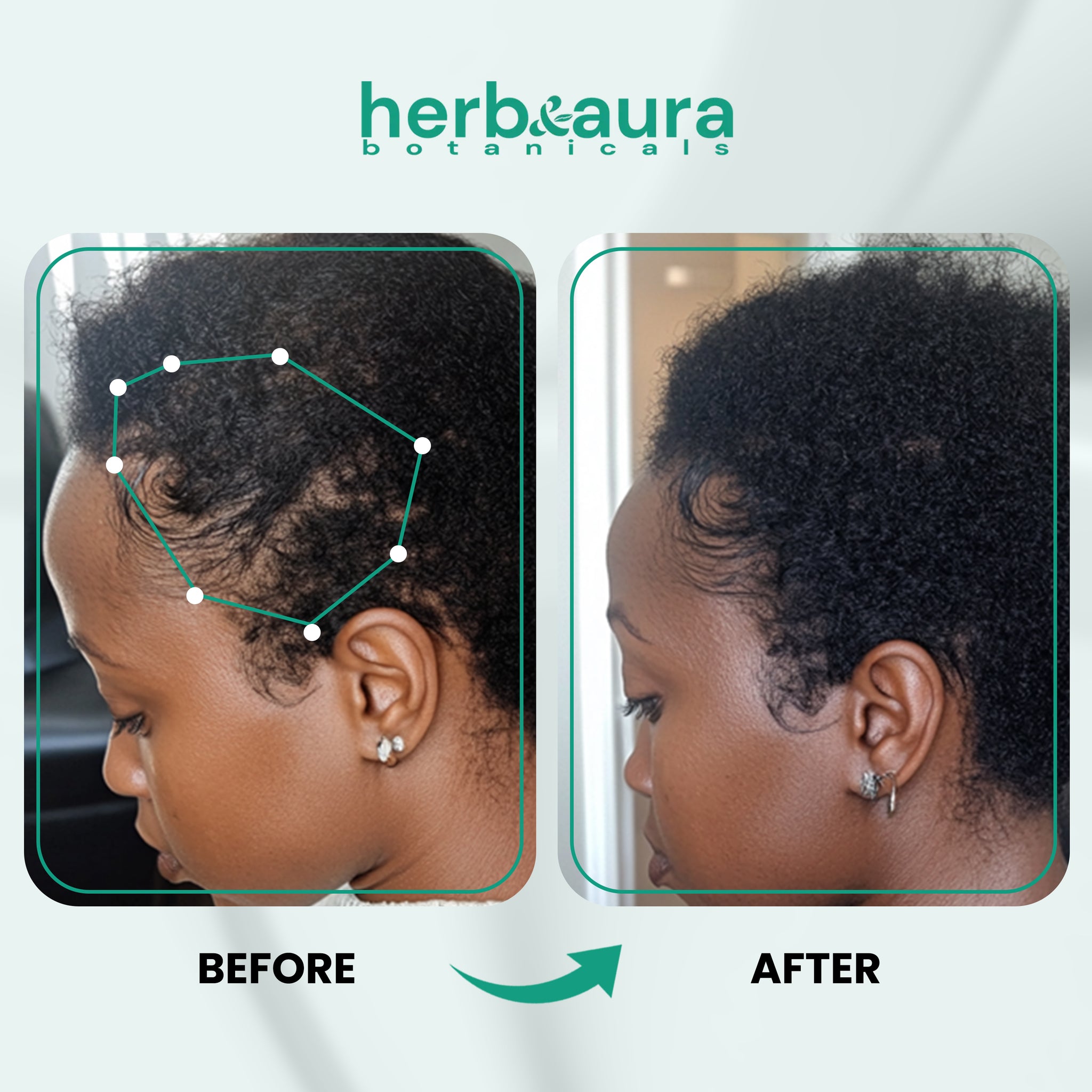 Raw Batana Oil for Hair Growth – 100% Authentic & Unrefined, Dr. Sebi Batana Hair Mask from Honduras, 4.9 fl oz. Promotes Thicker, Fuller, and Healthier Hair.