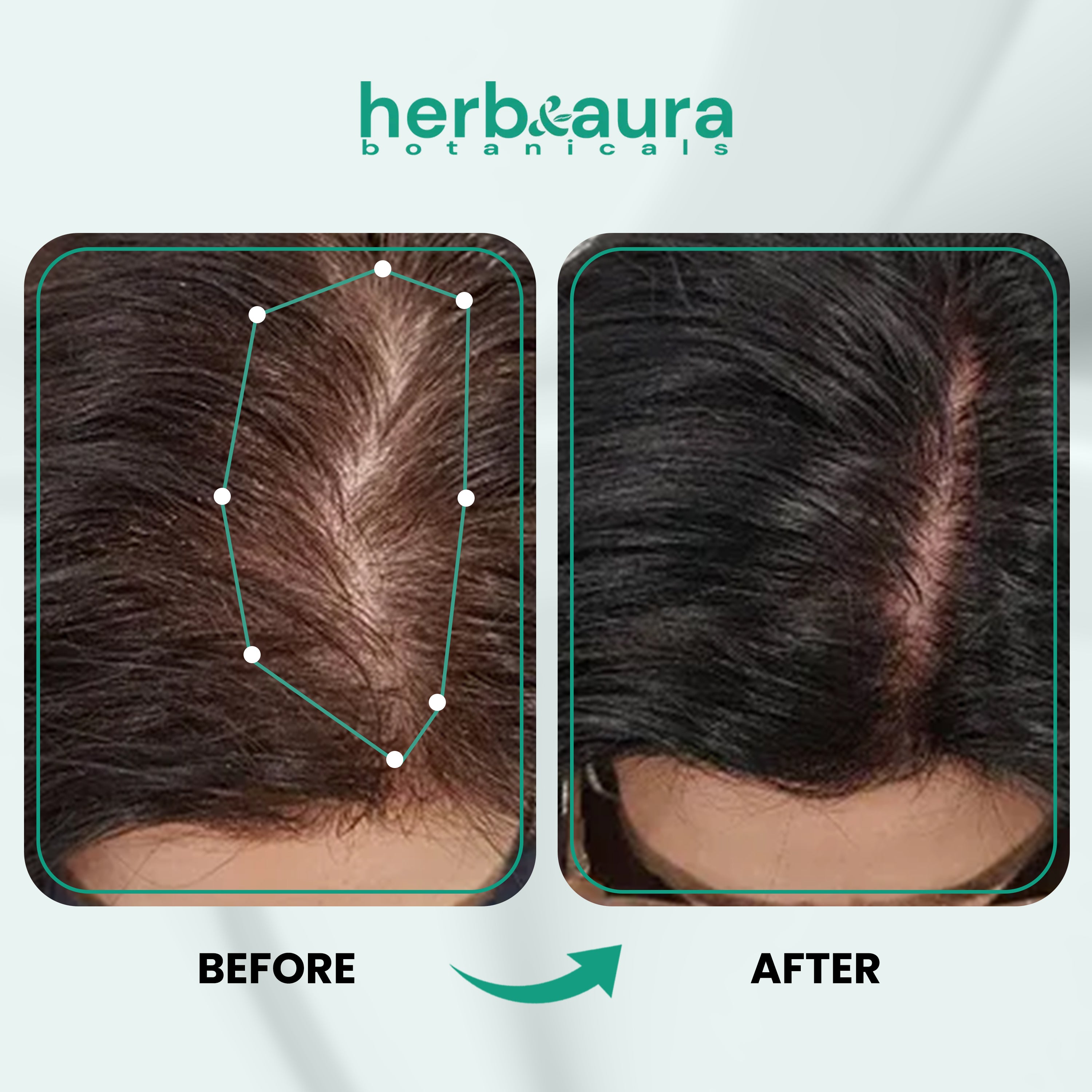 Unrefined Batana Oil for Hair Growth – Raw & Natural Hair Growth Oil from Honduras, 4.9 oz
