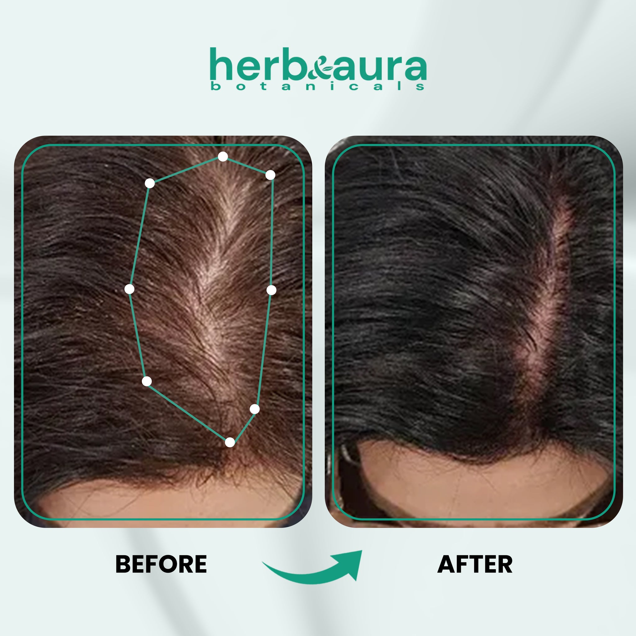 Raw Batana Oil for Hair Growth – 100% Authentic & Unrefined, Dr. Sebi Batana Hair Mask from Honduras, 4.9 fl oz. Promotes Thicker, Fuller, and Healthier Hair.